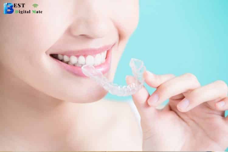 Know How Invisible Braces Can Help You Create Celeb-Like Smile