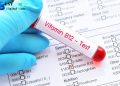 Vitamin B12 Test and Normal Vitamin B12 Levels- know the procedure and results